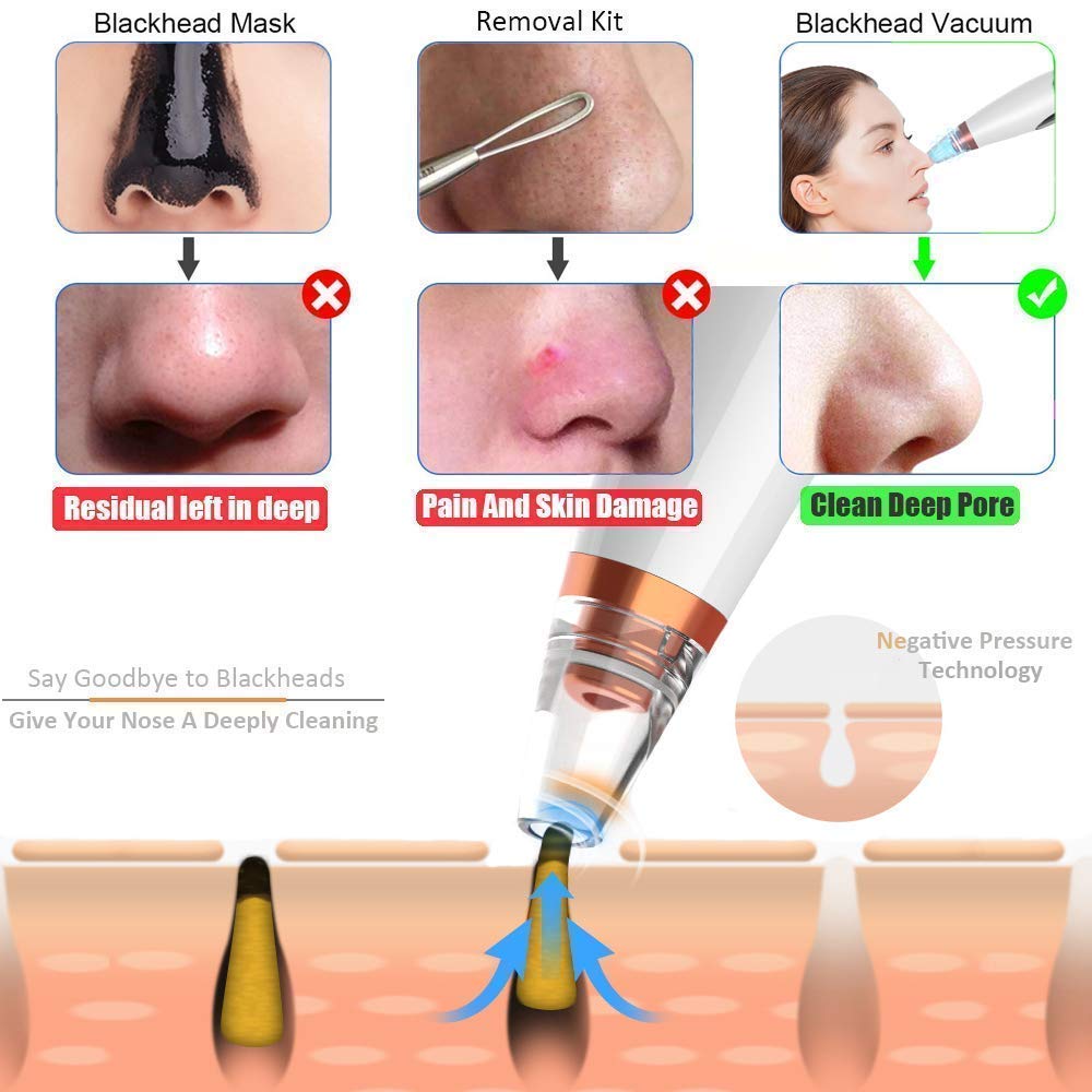 6 In 1 Derma Suction blackhead remover machine