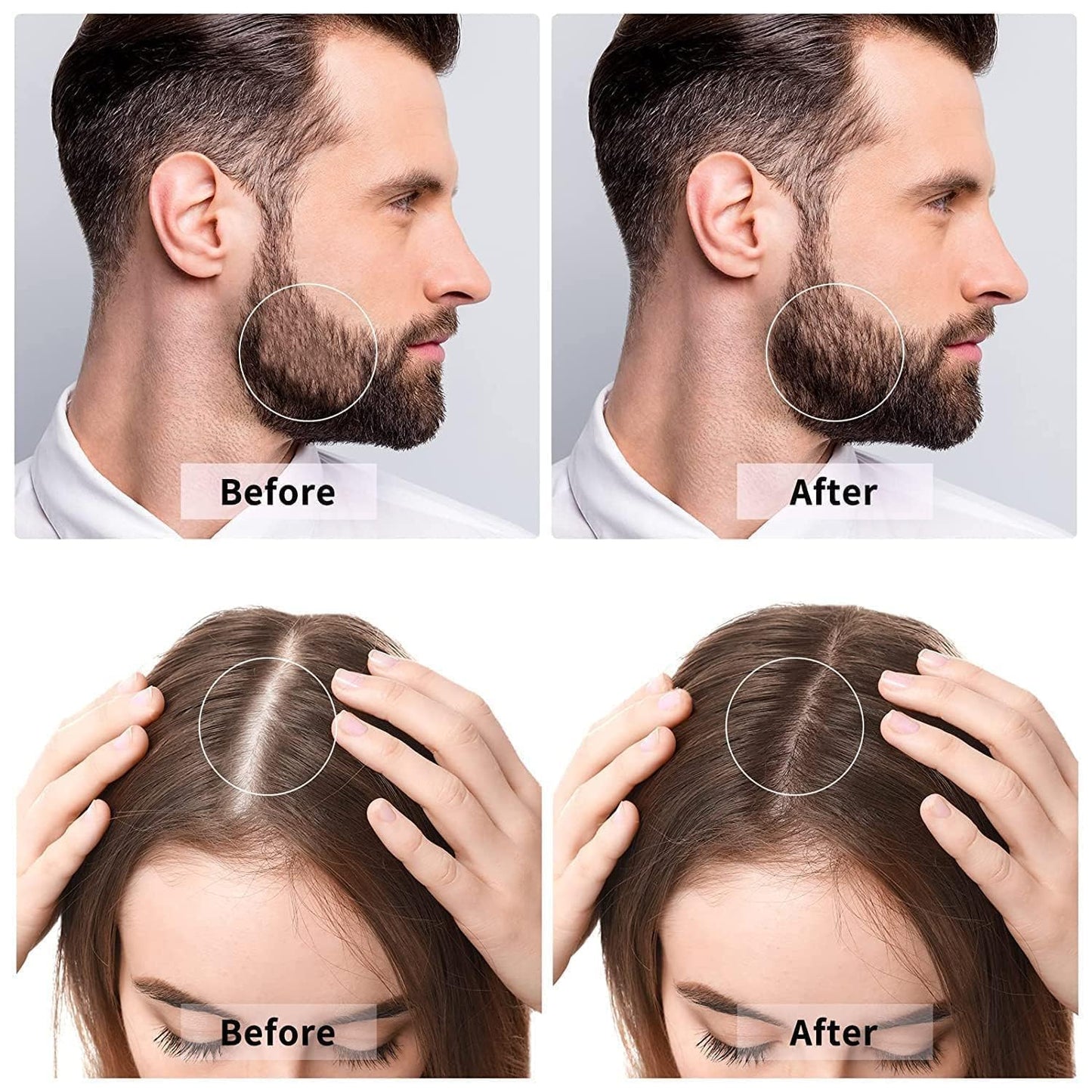 Derma Roller 0.5mm
