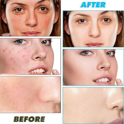 Kojic Acid and Turmeric Cleansing Pads